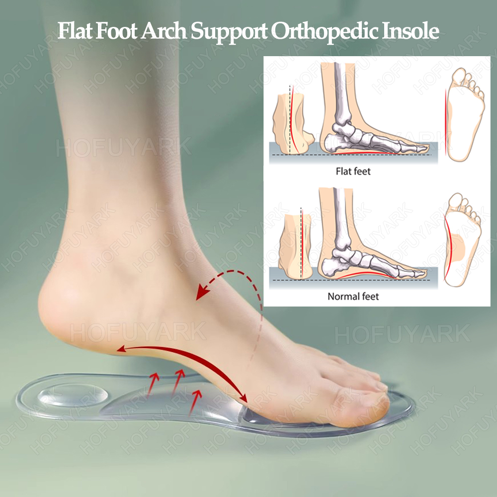 실리콘 젤 깔창 정형 외과 용 플랫 풋 아치 지원 발바 - Women'S Shoes With Plantar Fasciitis 리뷰 및 가격